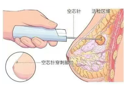 1754292519469999.png image.png